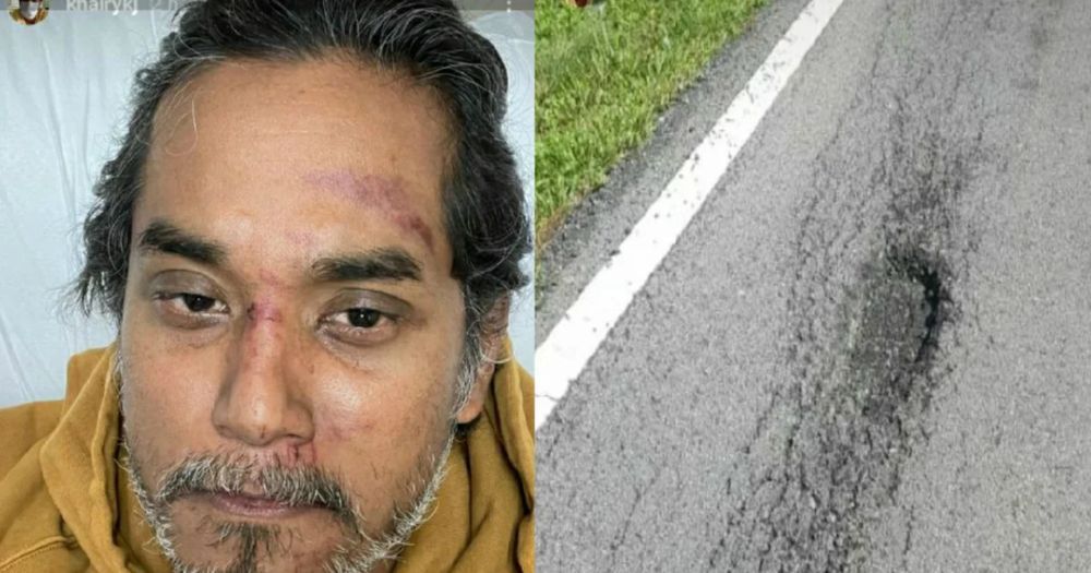 khairy Jamaluddin jatuh basikal